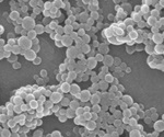 Understanding Particle Drift and its Influence on Oral Drug Absorption Using Flux Tools