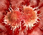 Study Shows How Age-Related Metabolic Decline Impairs the Efficacy of CAR-T Cell Therapy